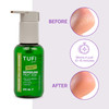 TUFI Profi BioPeeling Fruchtsäure-Hornhautentferner für weiche Füße, 100 ml (0330978) - Фото №3