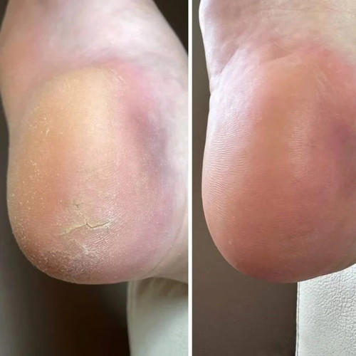 Resultum Anti-Riss-Creme Jojoba für Hände und Füße 50 ml - Фото №5