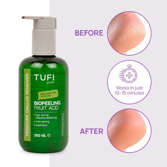 Hornhautentferner TUFI Profi BioPeeling Fruchtsäure-Hornhautentferner für weiche Füße, 250 ml (0330979) - Фото №2